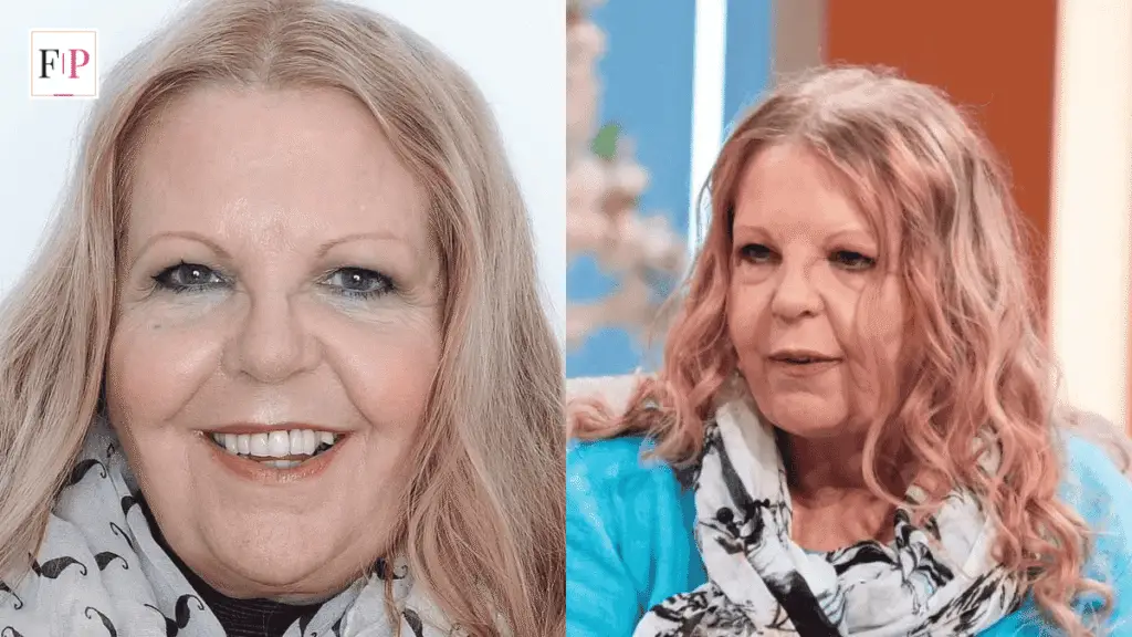 Sally Thomsett Face Illness