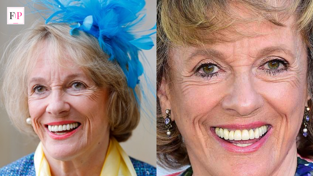 Dame Esther Rantzen Dies at 86: 9 Facts About the TV Legend Dame Esther Rantzen, the beloved That's Life! presenter and Childline founder who died aged 86